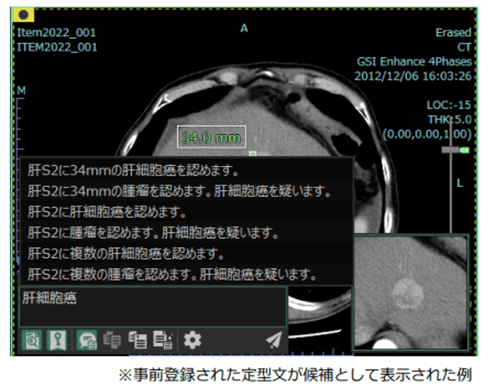 nlp1